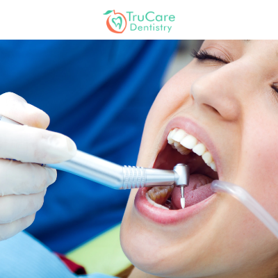 What are the different types of root canal treatment?