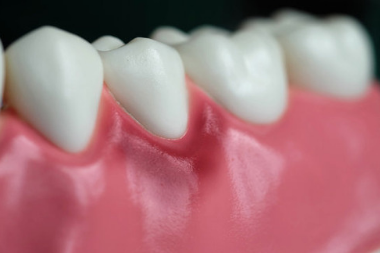 Crucial factors about gum disease and its treatment options