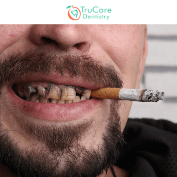 Effects of Smoking on Your Teeth & Oral Health