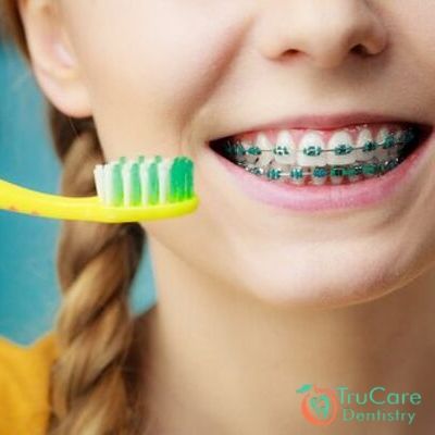 How to brush teeth with braces?