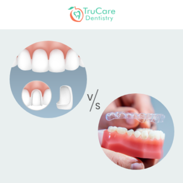 Porcelain Veneers or Invisalign? Which is the Better Option to Restore Your Beautiful Smile?