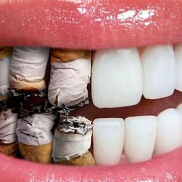 Is Smoking too Adverse for Oral Health?