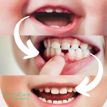 The Various Stages of Teething and Recommended Dental Care