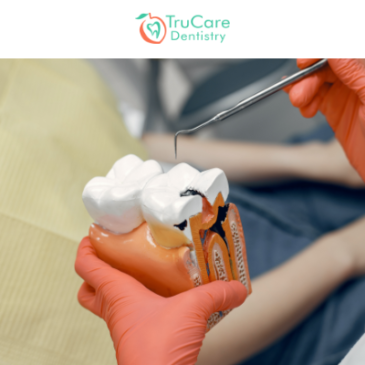 Did you know? An infected tooth can lead to multiple-organ-failure and death