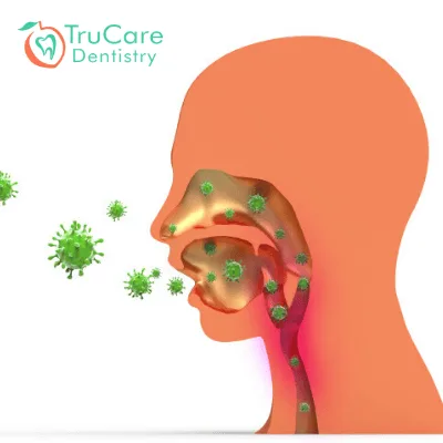 5 Myths About Mouth Cancer