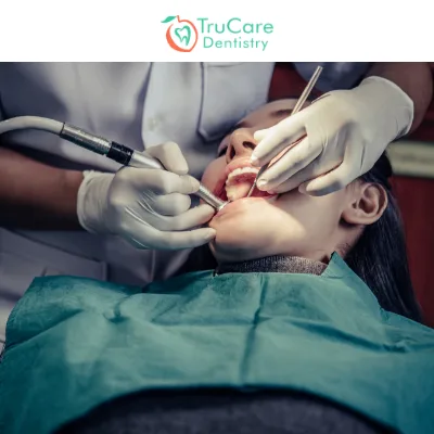 9 Benefits of Root Canal for Your Overall Oral Health