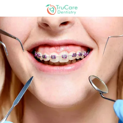 9 Effective Aftercare Tips for Orthodontic Treatment