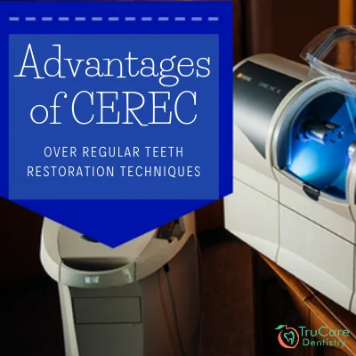 Advantages of CEREC