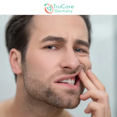 Cavities Vs. Stains Causes & Treatments