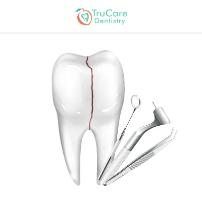 Cracked Tooth Causes