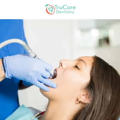 Dental Prophylaxis 101: Everything You Need to Know About It