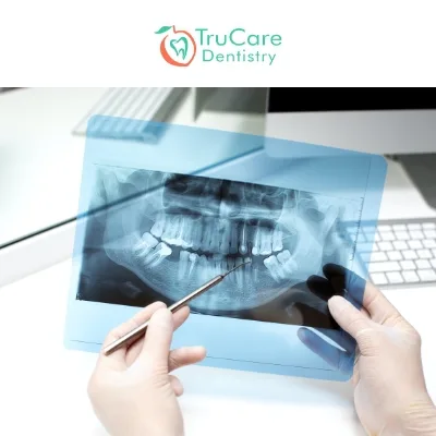 Dental X-Rays Are Essential