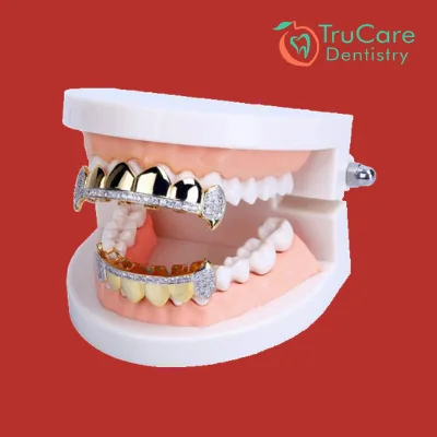 Effect of Dental Grills on Oral Health