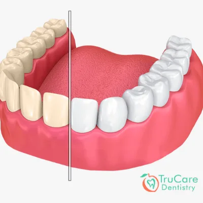 FAQs on Teeth Staining