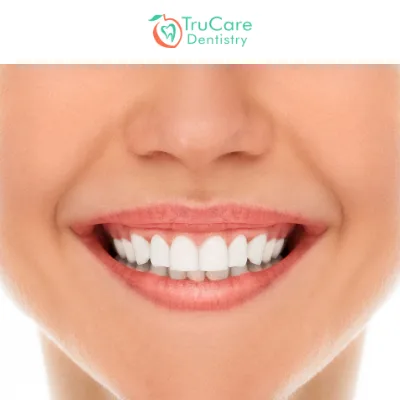 Gum Contouring