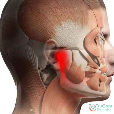 Here’re ten most common signs of TMJ disorders