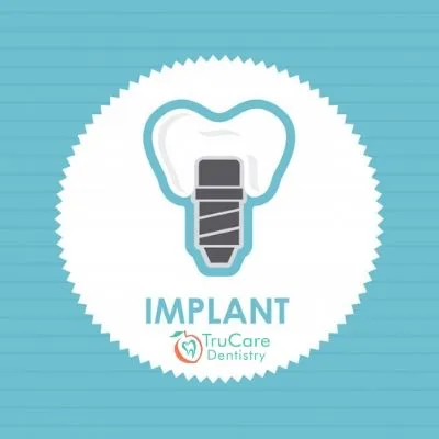 Here’re tips to ensure you have chosen the right dental implant dentist