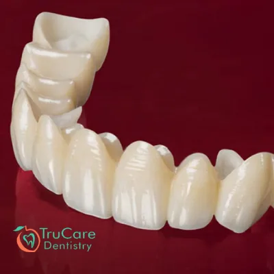 Here’s how zirconia crowns are different from all porcelain ones
