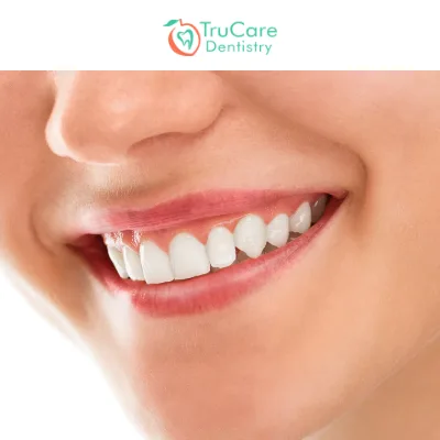 Here’s What You Need To Know About Dental Prophylaxis