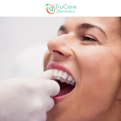 How Often Should You Change Your Invisalign Trays?