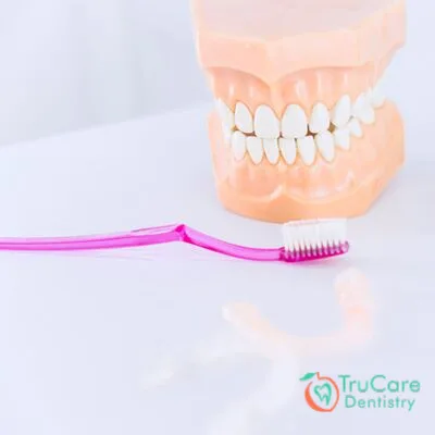 How to Clean Your Dentures and Prevent Bacteria From Building Up