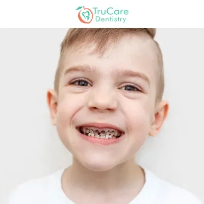 How to Prevent Enamel Erosion in Kids