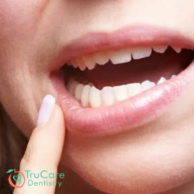 How to strengthen loose teeth