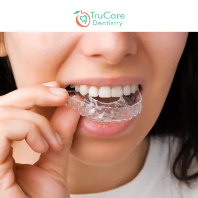 Invisalign Braces the Best Option for Overbite Treatment