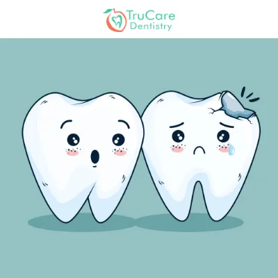 Know Everything about Cracked Teeth: Causes, Treatment, and Prevention
