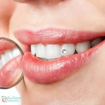 Oral Piercing and Dental Hygiene