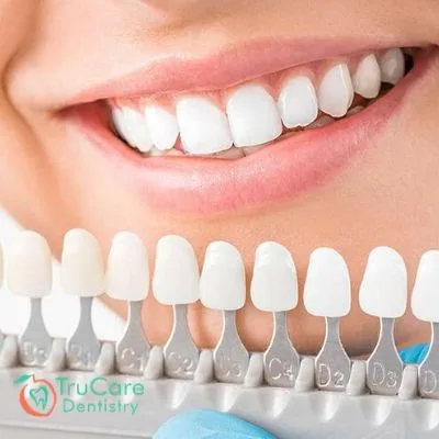 Pros and Cons of Cosmetic Dentistry
