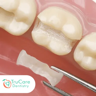 Restorative dentistry