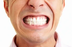 Teeth Grinding