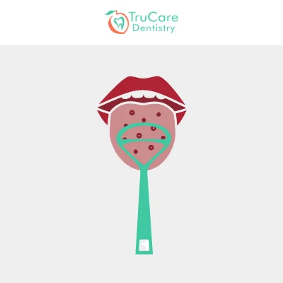 Tounge cleaning