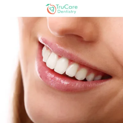 Which Dental Filling Should You Choose?