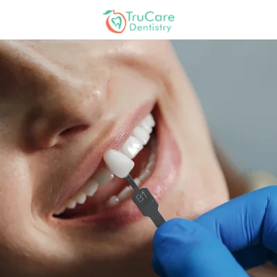 Veneers Vs Lumineers Know the Key Differences between Them