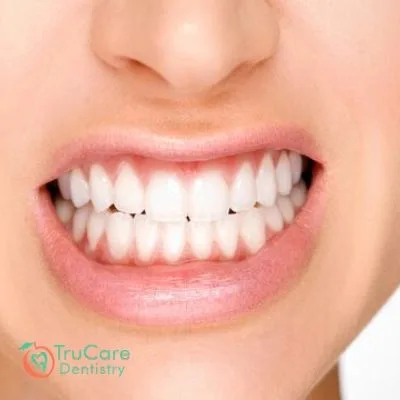 Ways You Can Stop Grinding Teeth During Sleep