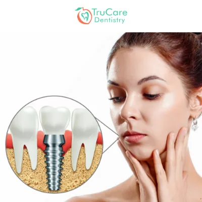 Deal with Pain in Temporary Dental Crowns