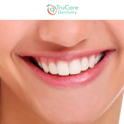 What Is Enameloplasty Is It Extremely Necessary for You