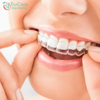 Which factors trigger the misalignment of teeth