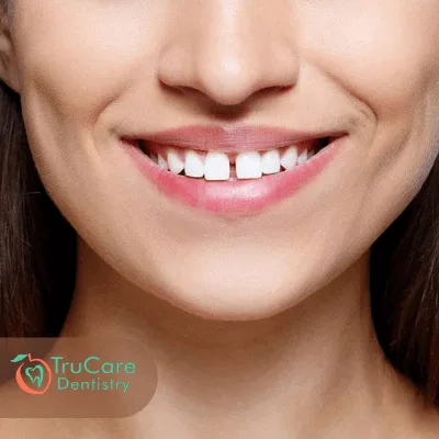 dental midline shift