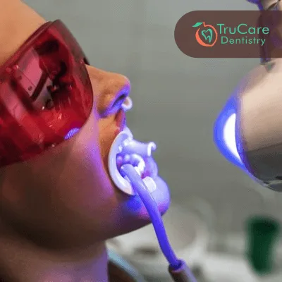professional teeth whitening